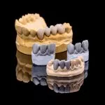 partial-dentures-dublin