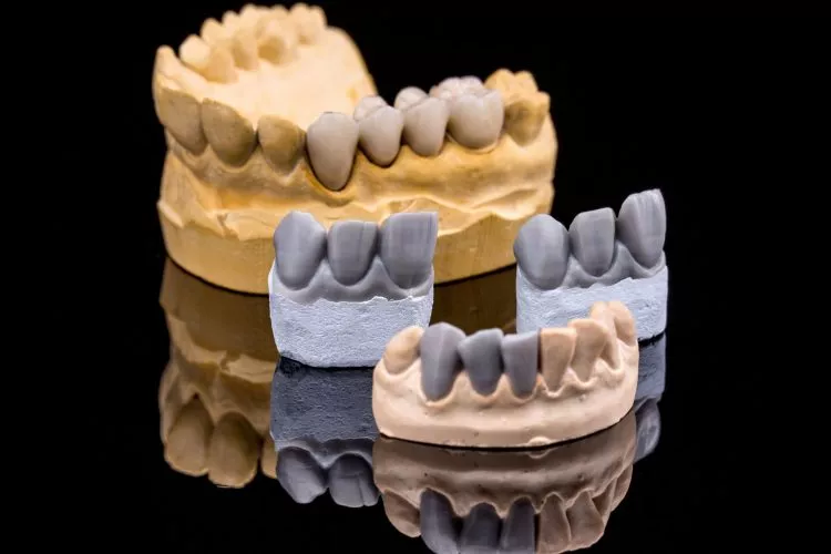 partial-dentures-dublin