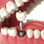 periodontist-dublin